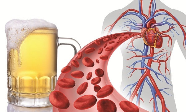 Lạm dụng rượu bia có thể làm tăng cholesterol trong máu và tăng nguy cơ mắc bệnh tim mạch